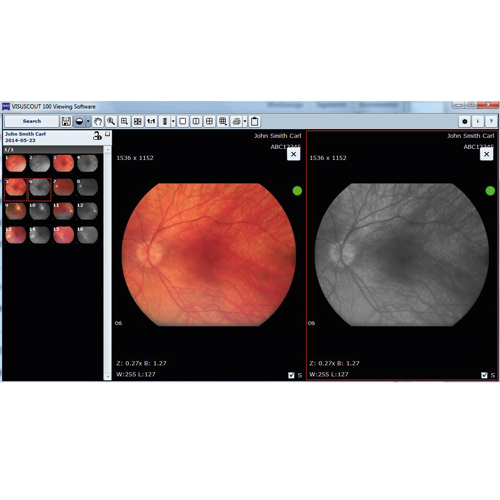 VISUSCOUT 100 Viewing Software (Licentie) productfoto